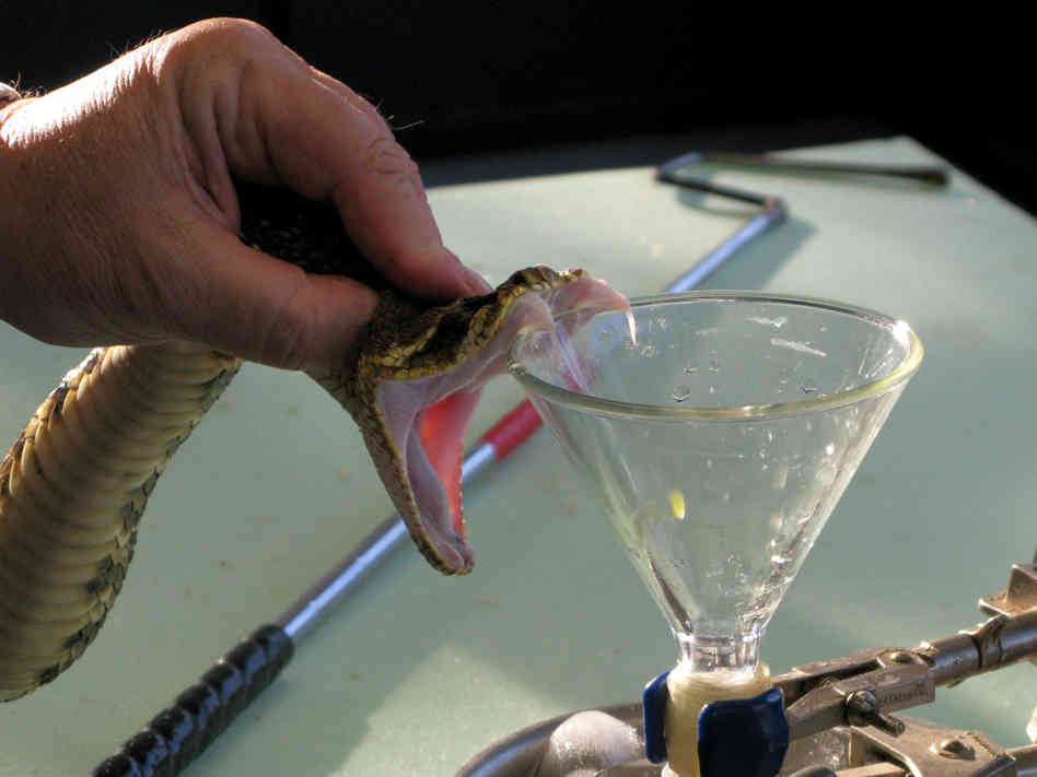 Snake Milker | Worst Jobs EVER